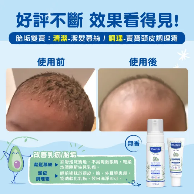 【Mustela 慕之恬廊】慕之幼 頭皮照護組(寶寶頭皮調理霜40ml＋潔髮慕絲150ml 胎垢雙寶 清潔胎垢乳痂杏賽)
