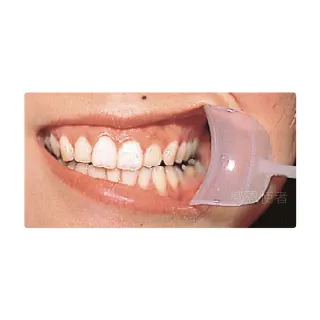【感恩使者】輕鬆開嘴器 E0120 -張嘴不易者使用(口腔護理 -日本製)