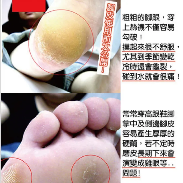 【日本Beauty Foot】去角質足膜 25mlx2枚入(二入組)