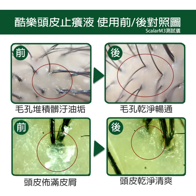 【arin 氧潤】居家頭皮淨化X隨身控臭油癢120ml x2組(頭皮水/頭皮精華/頭皮去角質)