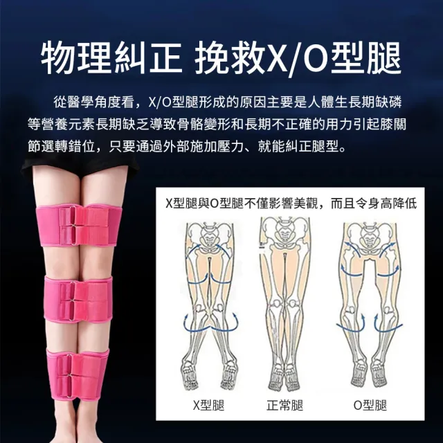 【OMG】日式腿型矯姿帶 直腿神器 綁腿帶/束腿帶 糾正羅圈腿/X型/O型/內八型腿/塑造自信美腿(XL碼)