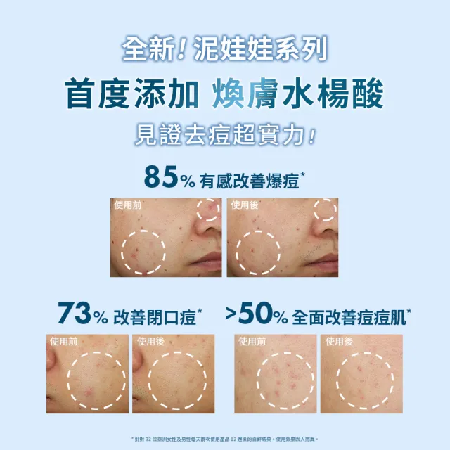 【ORIGINS 品木宣言】新上市 泥娃娃活性碳淨痘保濕調理乳50ml(淨痘小黑乳/新品上市)