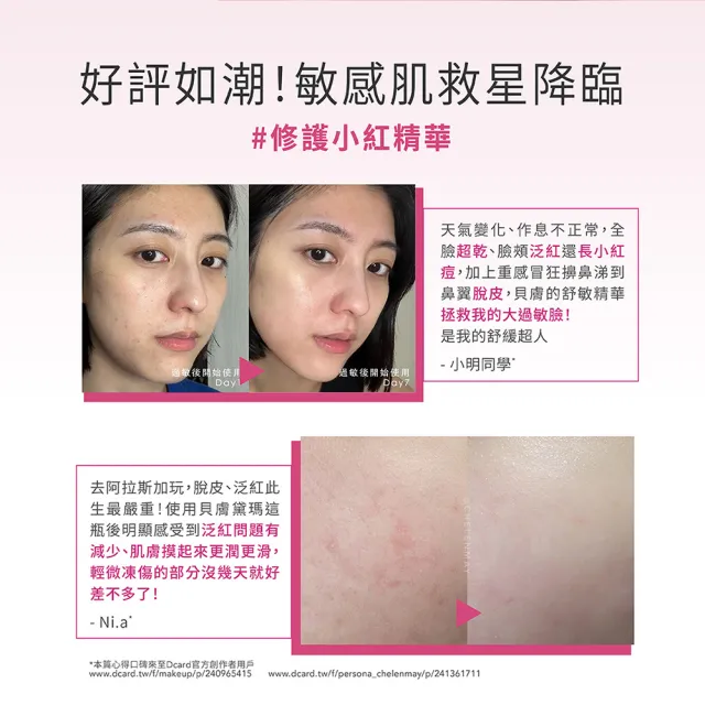 【BIODERMA 貝膚黛瑪 官方直營】舒敏抗老修護精華 30ml(2入組)