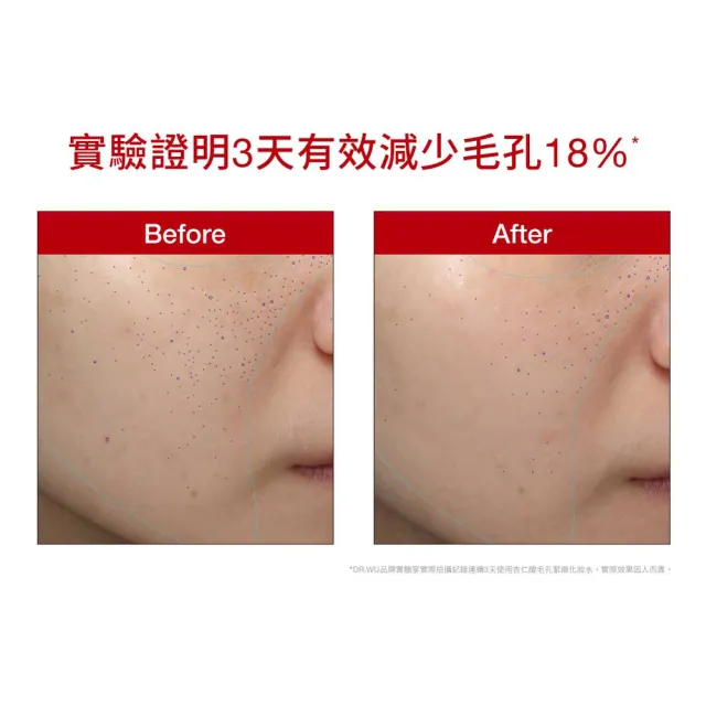 【DR.WU 達爾膚】杏仁酸毛孔緊緻化妝水150ML(2入組)