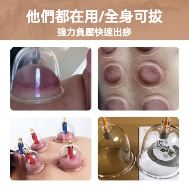 【華佗牌】24杯真空拔罐組(禮盒 送禮 拔罐杯 拔罐器 手動真空拔罐)