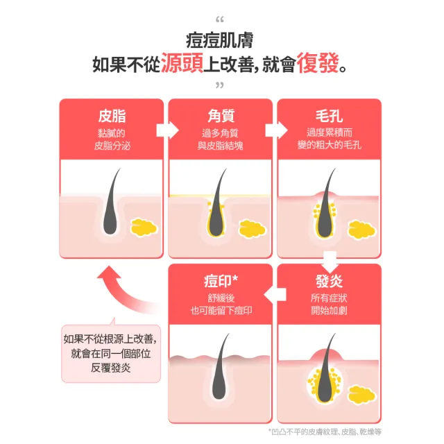 即期品【AESTURA 璦絲特蘭】每日清痘倍護淨透水分煥活保濕霜 60ml(保濕/抗痘/痘痘調理/水楊酸)