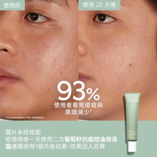 【CAUDALIE 歐緹麗】抗痘精華保濕組(葡萄籽淨化抗痘精華+葡萄籽抗痘控油保濕霜)