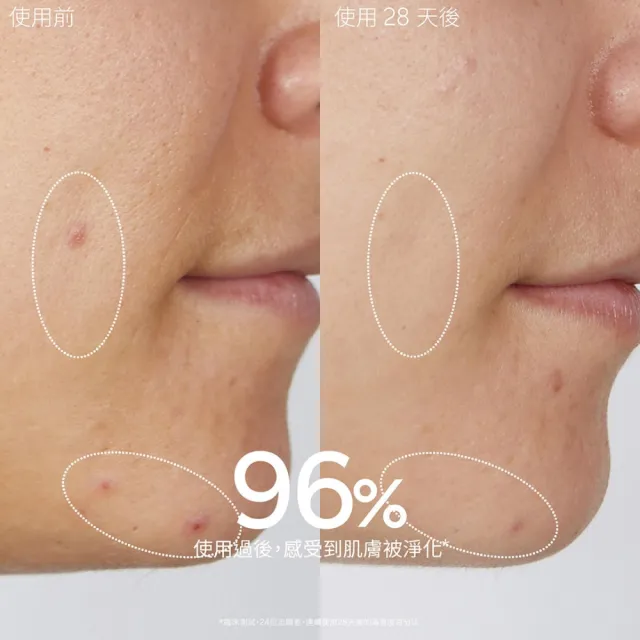 【CAUDALIE 歐緹麗】葡萄淨化抗痘凝露 15ml(全新包裝)