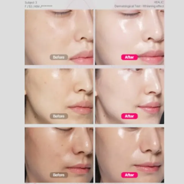 【HEALIC】傳明酸水光亮白組1+1 韓國藥局 改善暗沉蠟黃 棉片70片／盒 面霜60g/條