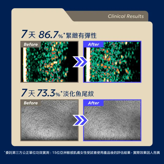 【AQUAMAX 奧科美氏】PDRN奢養修護蘭萃雙星組(精華+霜)-修護、抗老、舒緩、淡紋、植泌體、乳霜