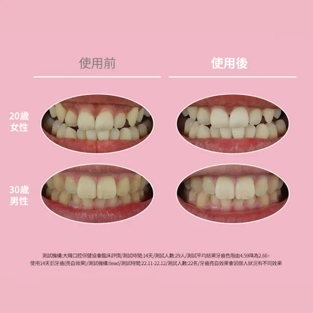【Euthymol】粉紅亮白牙膏(花漾沁桃薄荷106g)