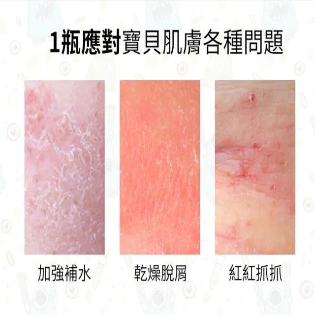 【Hallmark】怪獸派對 自然之萃寶寶全面修護乳 120ml 兩入組(舒緩 滋潤 身體保養 肌膚友善)