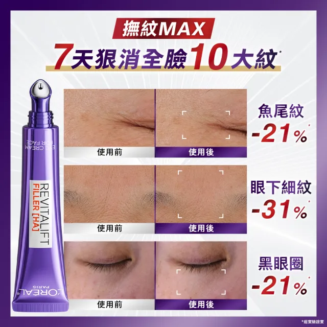 【L’OREAL Paris 巴黎萊雅】全新升級! 無針撫紋雙霸紫熨斗眼霜1+1組(冰熨斗+紫熨斗MAX3.0版)