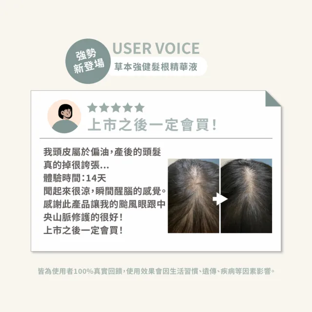 【Pxppy】草本強健髮根精華液2入組 Poppy21罌粟狂想 滋養頭皮 油水平衡 強健髮根 豐盈蓬鬆