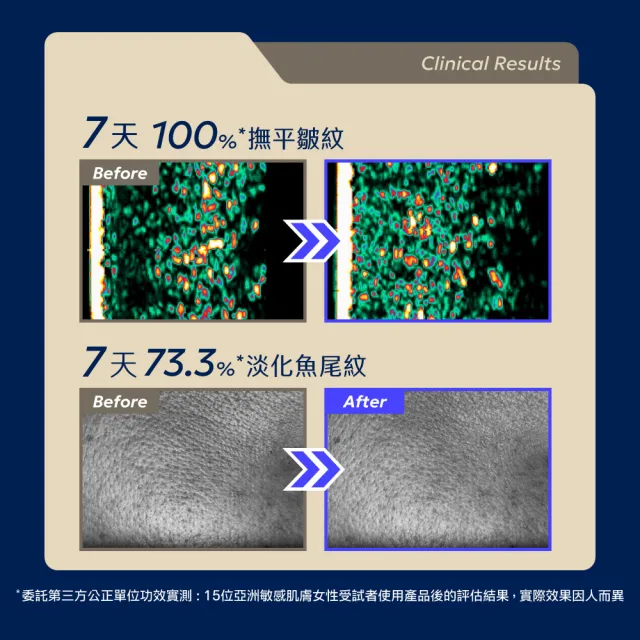 【AQUAMAX 奧科美氏】Exorigin泌蘭PDRN逆時新生超級霜 30g-修護、抗老、舒緩、淡紋、植泌體、乳霜