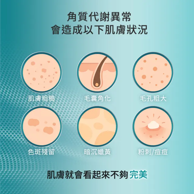 【Neogence 霓淨思】3% 6酸拋光舒緩凝乳50ml