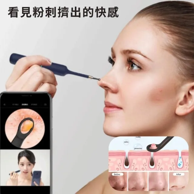 【BEBIRD】BEBIRD ADAM3 ULTRA 蛇型彎取可視掏耳棒(2025 嘖嘖爆品 亞當 禮贈品 送禮)