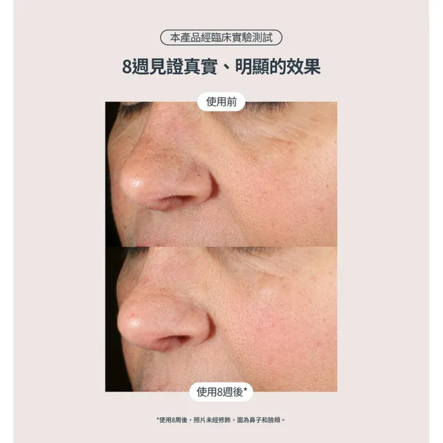 【StriVectin 皺效奇蹟】超越買1送1★皺效緊緻繃繃精華50mlx2(歐美院線/皮膚科推薦/緊緻肌膚)