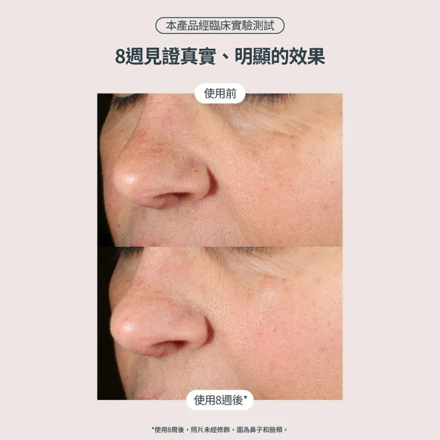 即期品【StriVectin 皺效奇蹟】皺效緊緻繃繃精華50ml(歐美院線/皮膚科推薦/緊緻肌膚)