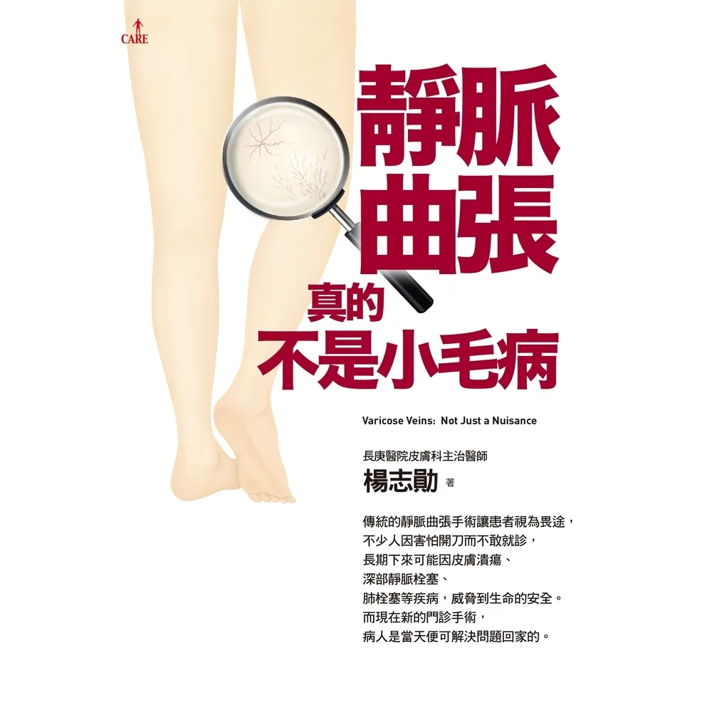 【momoBOOK】靜脈曲張 真的不是小毛病(電子書)