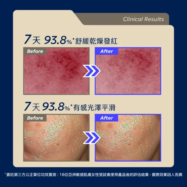 【AQUAMAX 奧科美氏】泌蘭 PDRN舒敏新生超級精華 2入分享組｜新生小蘭瓶PRO、女大推薦、術後穩膚、植泌體