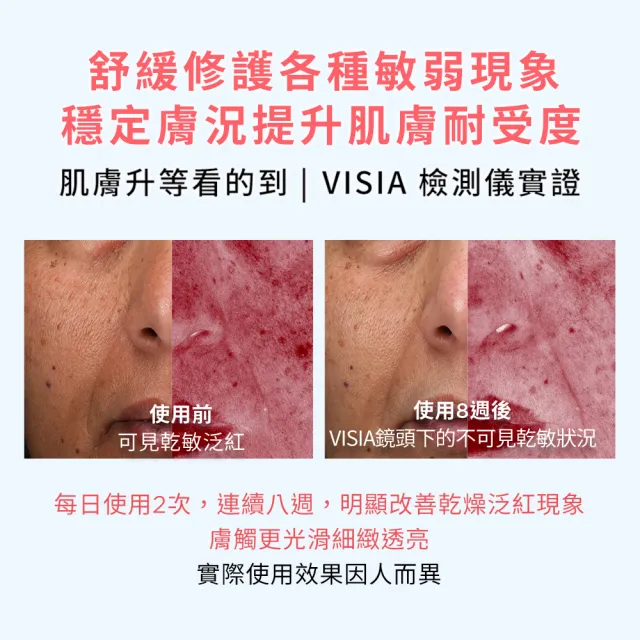 【DARPHIN 朵法】粉紅限定旅行組(全效舒緩精華50ml+30ml/小粉紅)