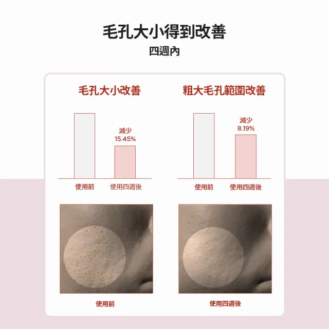【Skin1004】官方直營 馬達加斯加積雪草{粉鹽}緊致毛孔清爽化妝水 210ml