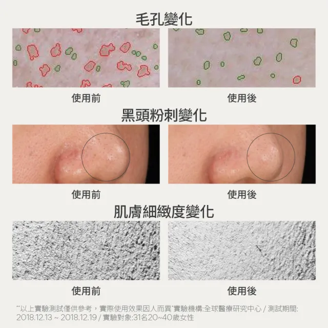 【innisfree】超級火山泥毛孔潔淨面膜 80g (3入組/毛孔吸塵器/水楊酸/控油)
