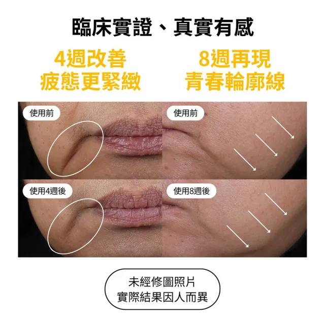 【StriVectin 皺效奇蹟】皺效緊緻繃繃臉霜50ml(超越買1送1/拉提緊緻/垮臉剋星)