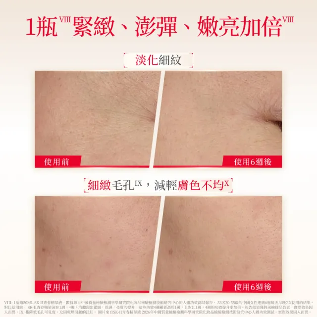 【SK-II】官方直營 青春精華液 30ml(青春鎖精華/青春鎖/抗老/淡化細紋/細緻毛孔/保濕/新品)