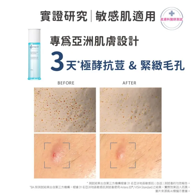 【d program 敏感話題】極效水乳均衡組 (水+乳)(淨膚/保濕 任選)(敏感肌/敏弱肌/油痘肌/乾肌)