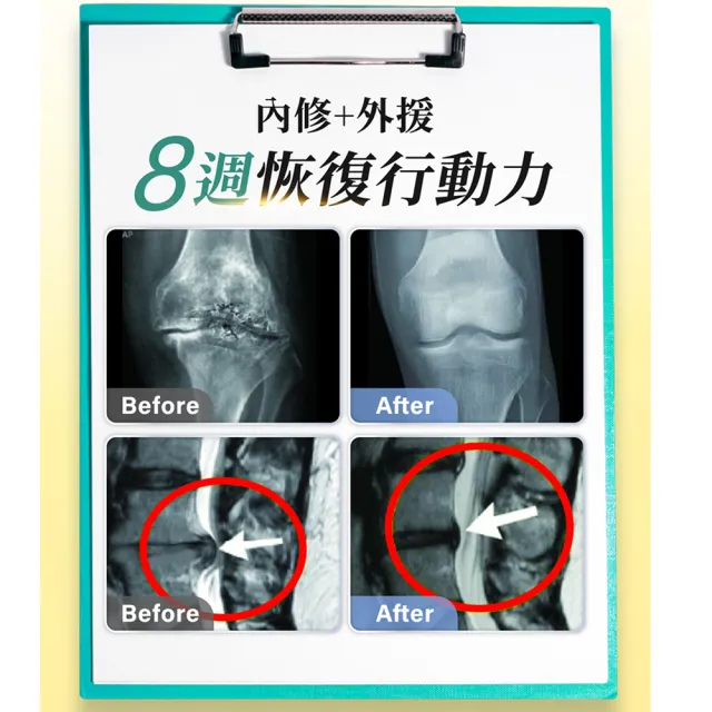 【AmaBios 亞馬生醫】MPE-311靈活粒現16盒(30粒/盒 專利鹿茸多萃取)