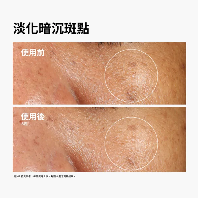 【The Ordinary】2% α熊果素+ 玻尿酸精華 30ml