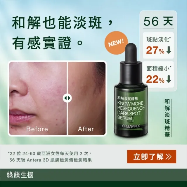 【greenvines 綠藤生機】嶄新上市★和解淡斑精華15ml 送保濕清潔體驗組 (不含光敏成分/不反黑/全膚質適用)