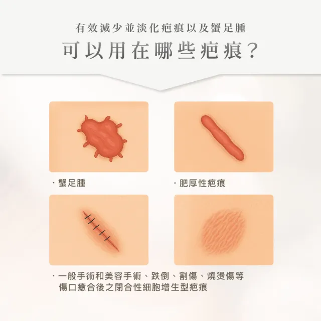 【Stratpharma 施得膚美】舒坦膚凝膠 1條入 10g/條 Strataderm(瑞士原廠進口/除疤凝膠)